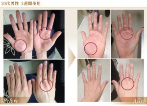 http://www.neolifer.jp/waterglove/より引用